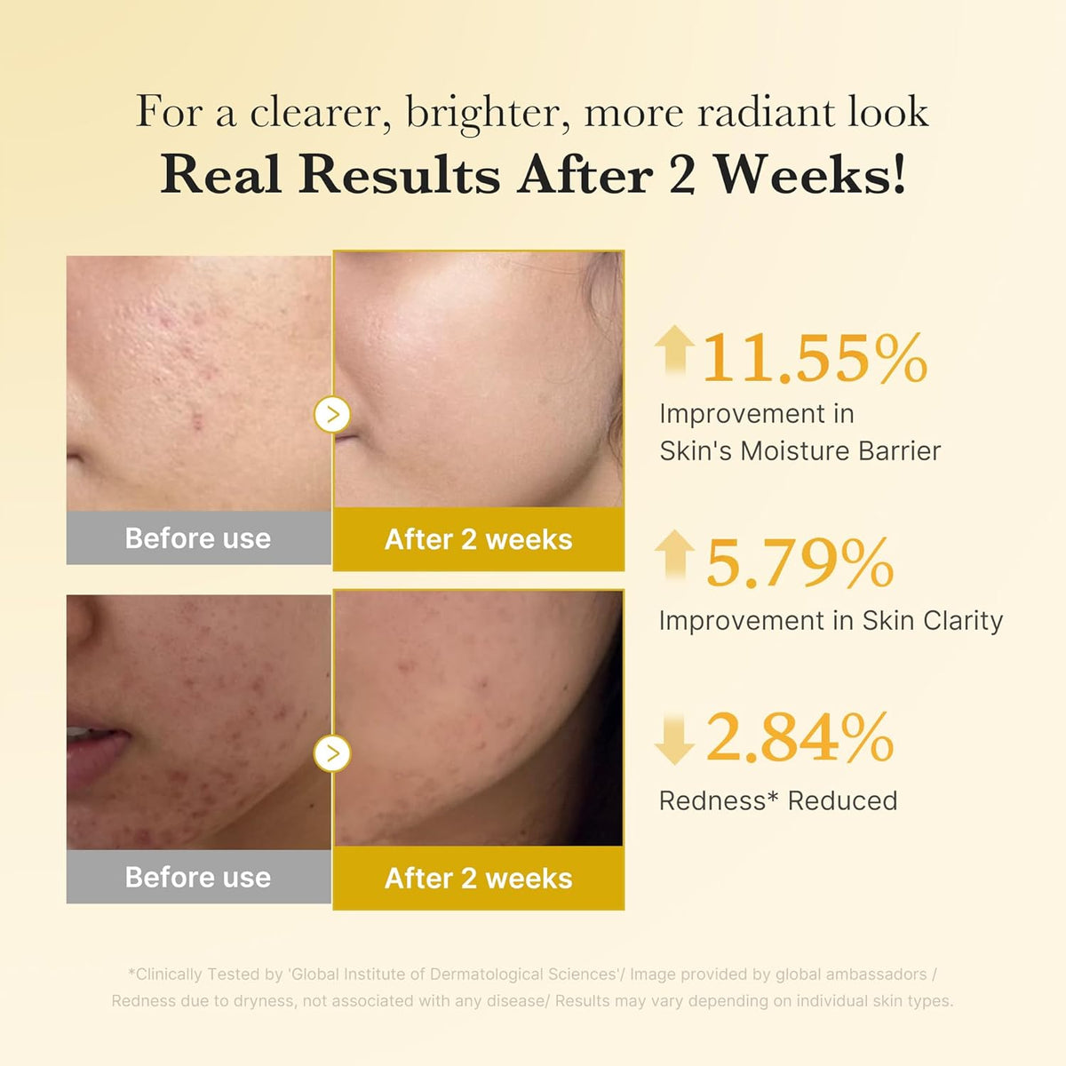 Medicube Kojic Acid, Turmeric & Niacinamide Serum — Siero Illuminante Anti-Macchie
