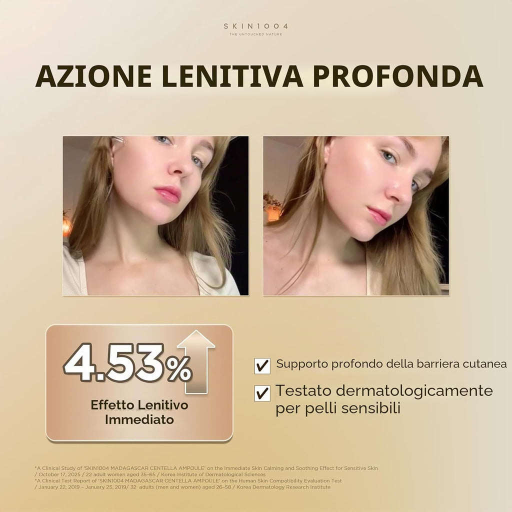 Skin1004, Centella Asiatica del Madagascar / siero viso/estratto 100% di centella asiatica/lenitivo, per pelli sensibili e a tendenza acneica