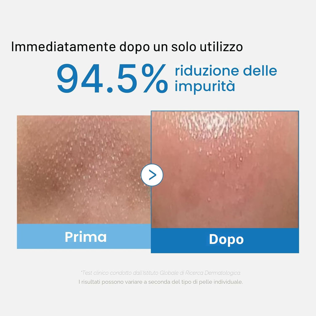 Medicube – Zero Pore Blackhead Deep Cleansing Oil | Olio Detergente Pori K-Beauty
