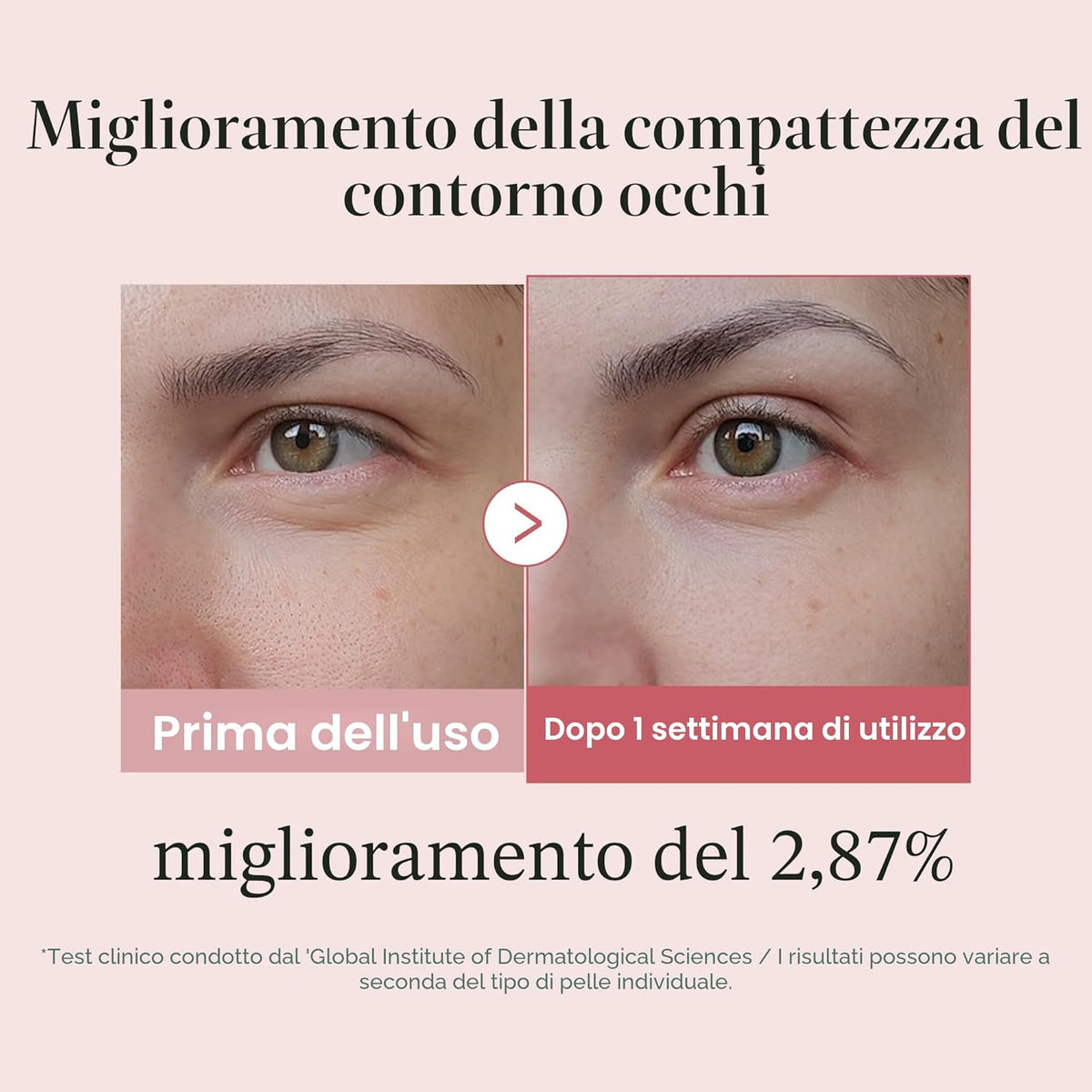 Medicube Eye Serum PDRN Salmone & Pink Peptides — Contorno Occhi Anti-Età