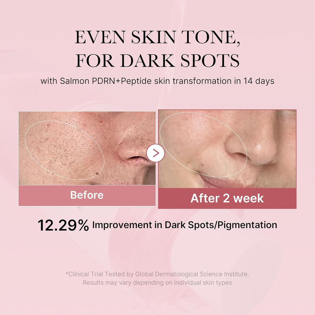 Medicube PDRN Salmon DNA & CICA Soothing Toner — Tonico Lenitivo Anti-Rossore