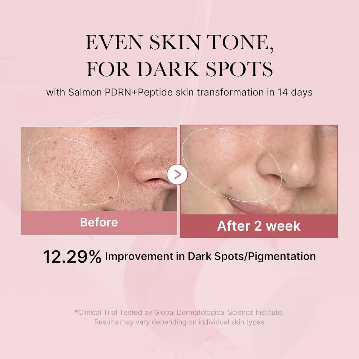 Medicube PDRN Salmon DNA & CICA Soothing Toner — Tonico Lenitivo Anti-Rossore