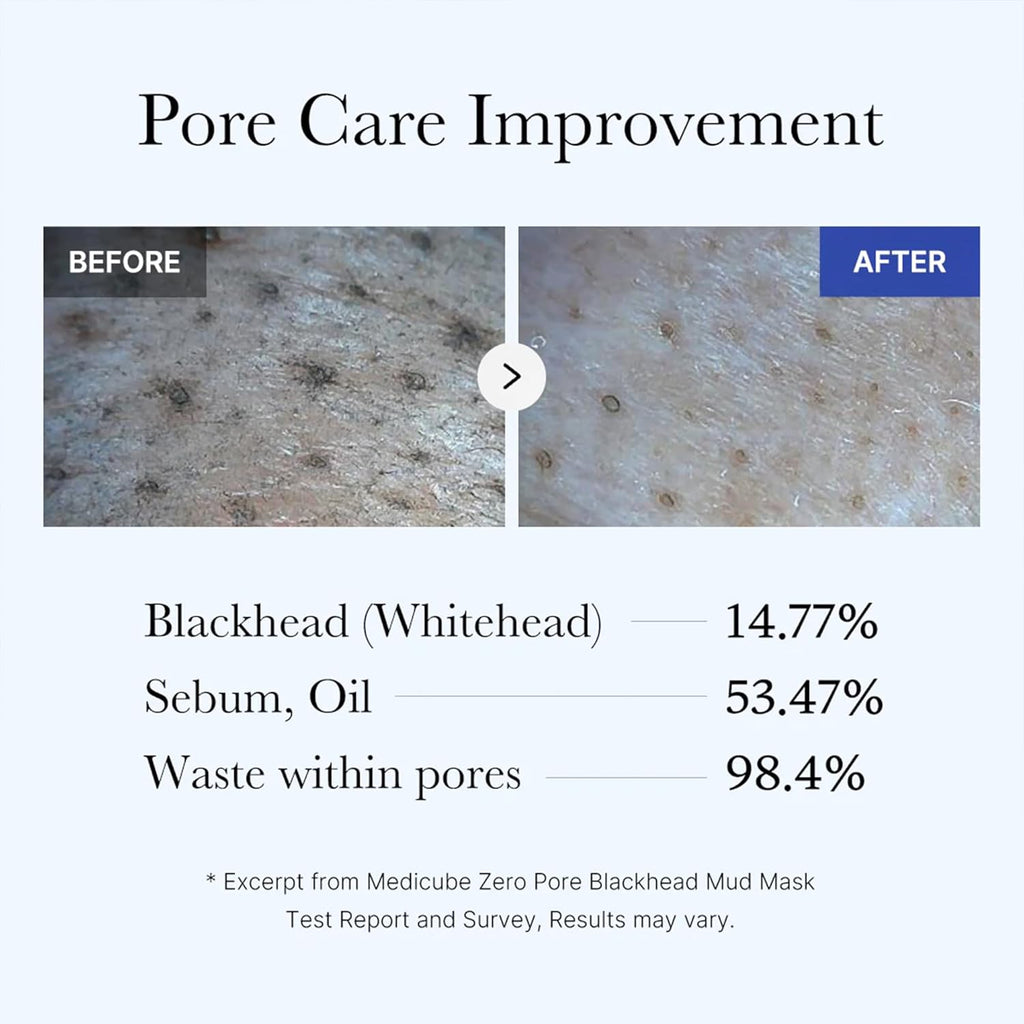 medicube Zero Pore Blackhead Mud Facial Mask | Maschera all'Argilla Coreanaz Rinfrescante, Restringe i Pori, Formula Rapida 3 Minuti con AHA, BHA, PHA & Argilla, 100 g