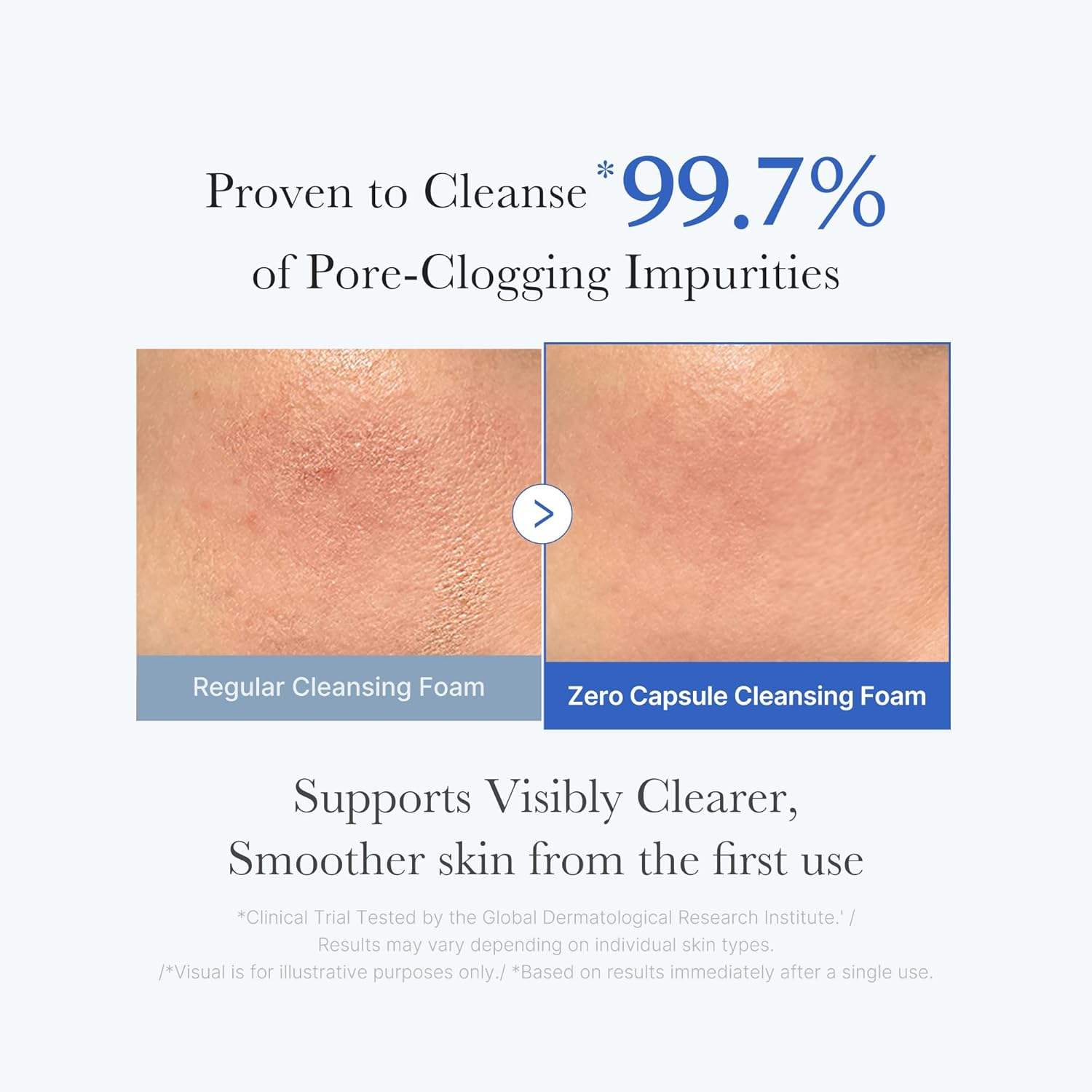 Medicube – Zero Pore Cleansing Foam | Detergente Viso Pori K-Beauty